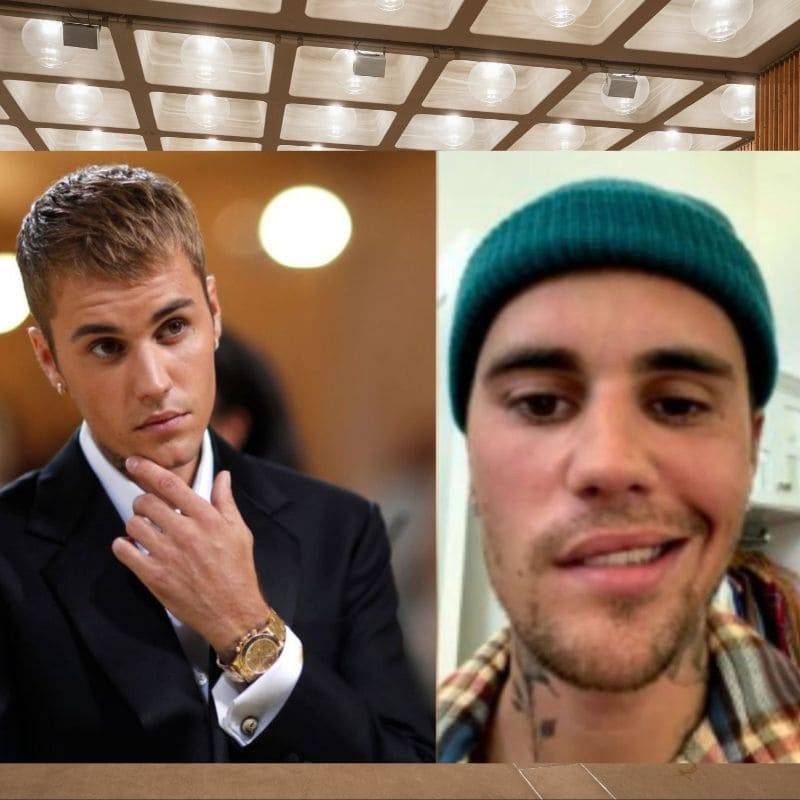 What is Ramsay Hunt Syndrome, affecting Justin Bieber?